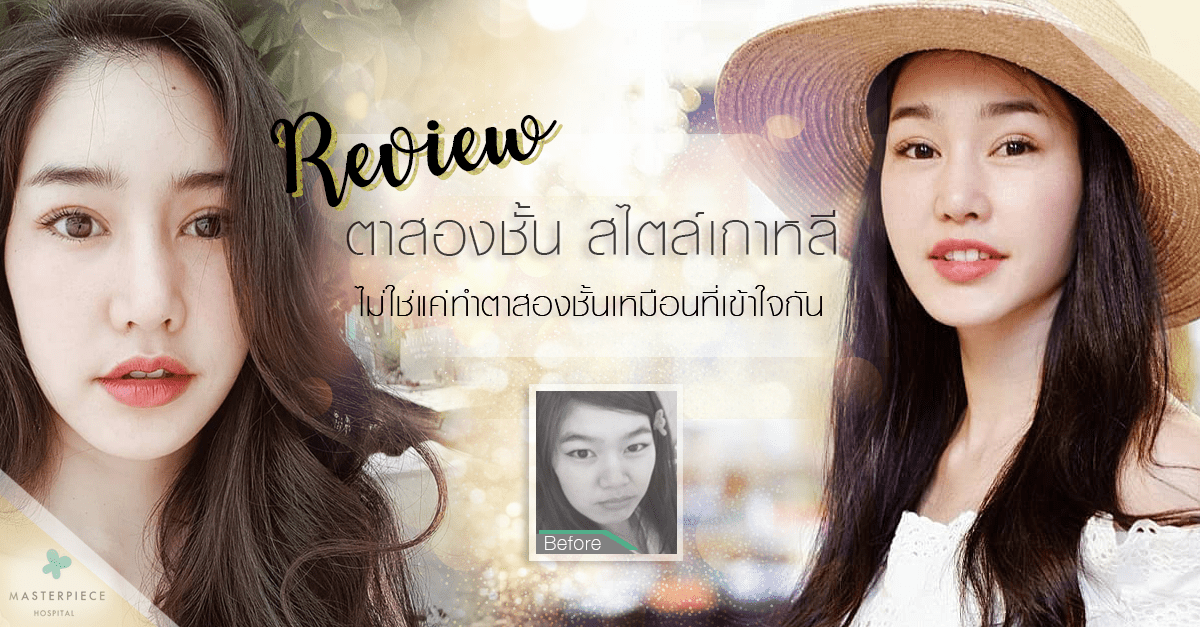 Review ตาสองชั้น สไตล์เกาหลี ไม่ใช่แค่ทำตาสองชั้นเหมือนที่เข้าใจกัน