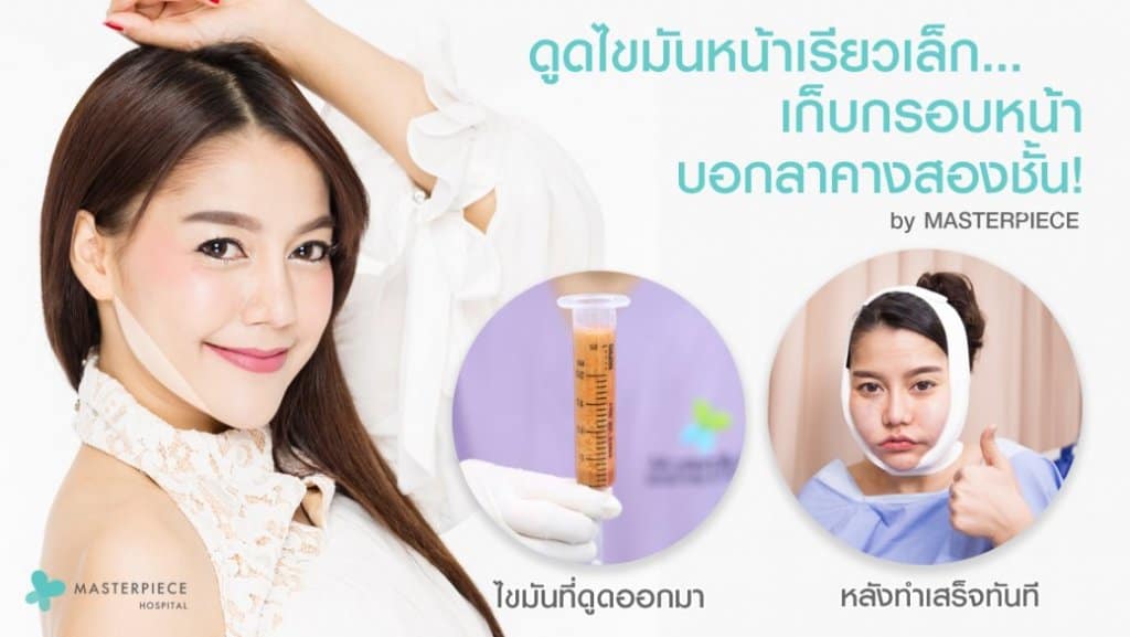 ดูดไขมันหน้า Facial Vaser Liposuction - Masterpiece Hospital