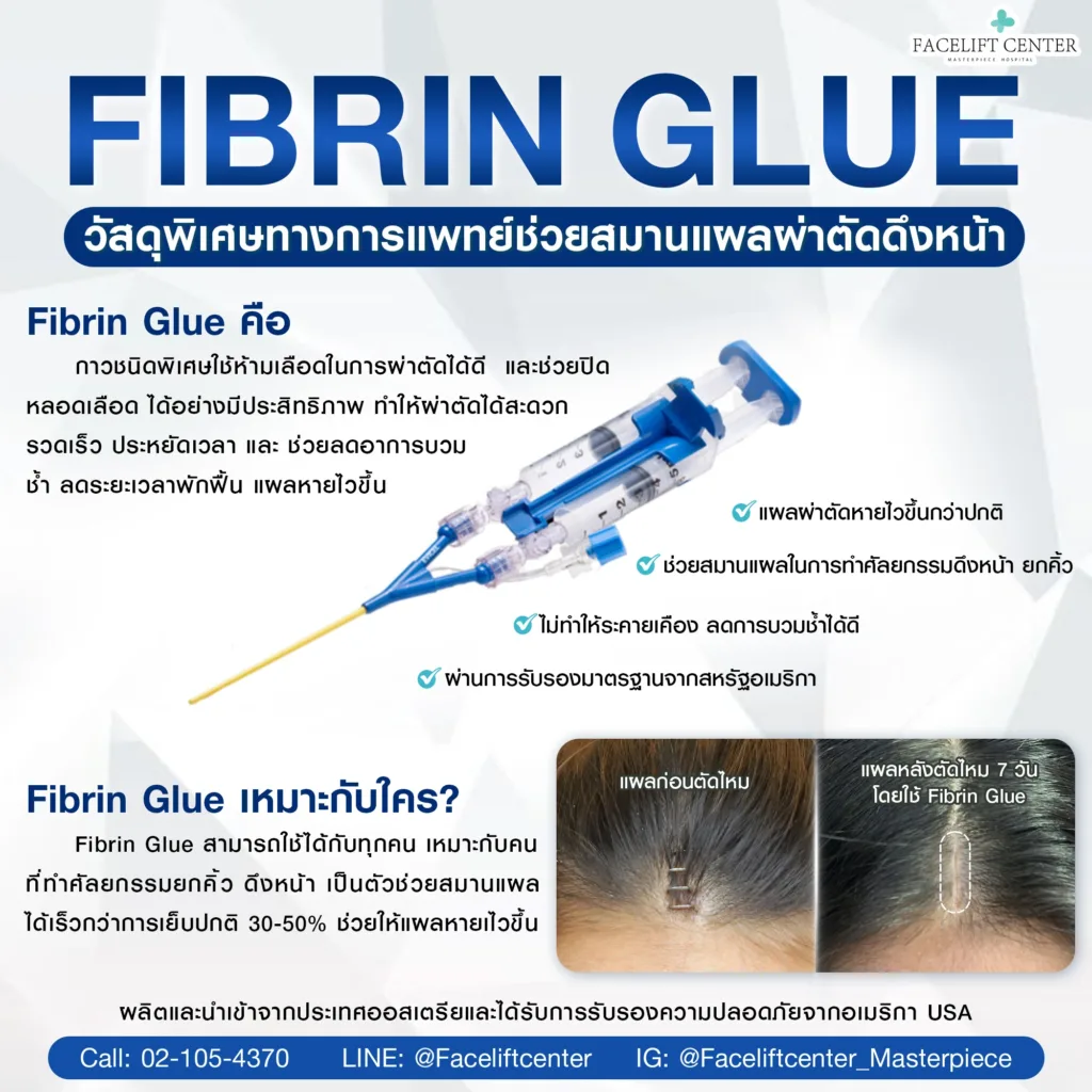 Fibrin-glue ;วัสดุพิเศษสมานแผลทางการแผทย์