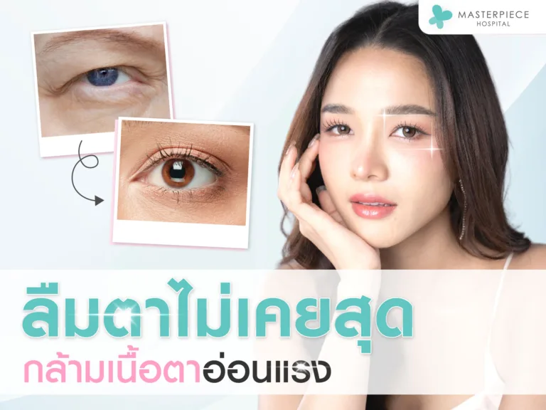 ลืมตาไม่เคยสุด ! เพราะกล้ามเนื้อตาอ่อนแรง (PTOSIS)