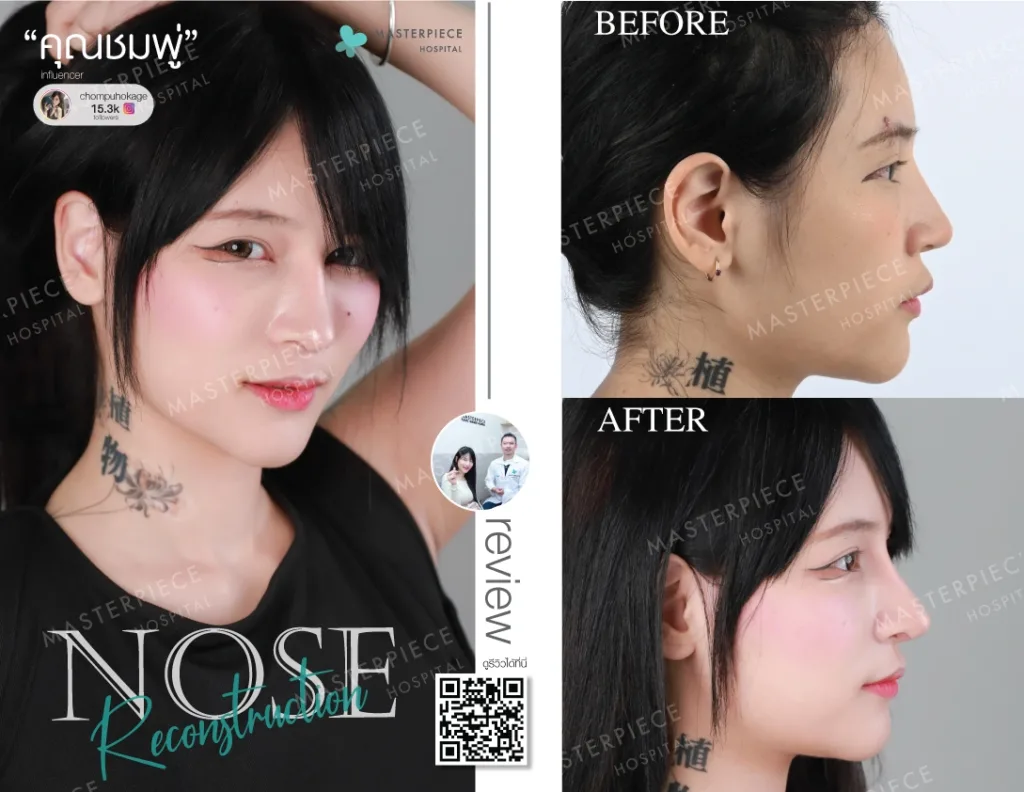 ReviewNose05