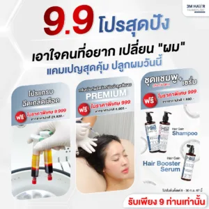 โปรโมชั่น ปลูกผม โรงพยาบาลมาสเตอร์พีช