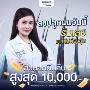 โปรโมชั่น ปลูกผม โรงพยาบาลมาสเตอร์พีช