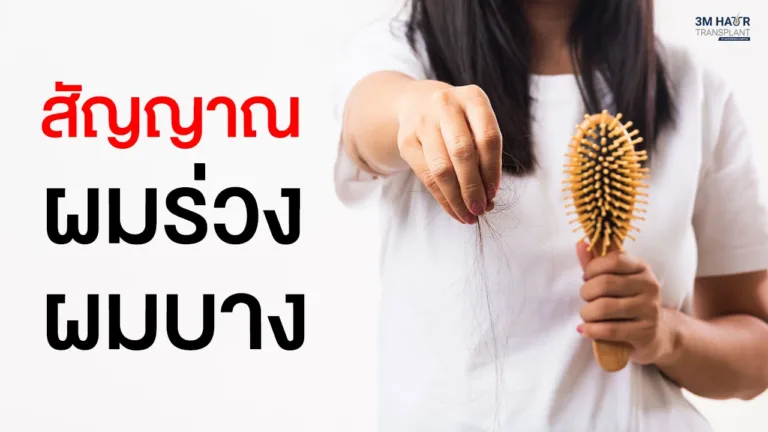 ผมร่วง ผมบาง เกิดจากอะไร สัญญาณเตือนผมขาดร่วงและวิธีรับมือ