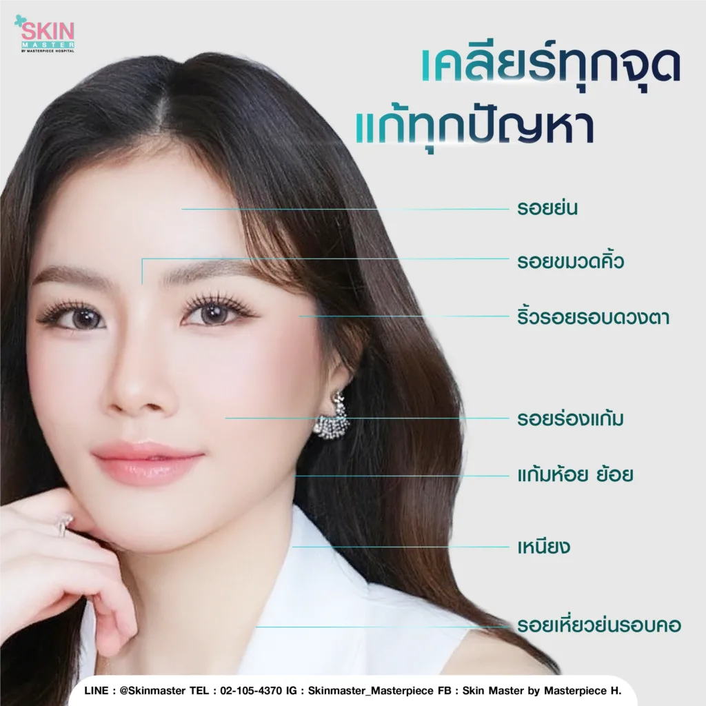 Morpheus8 เคลียร์ทุกจุด แก่ทุกปัญหา