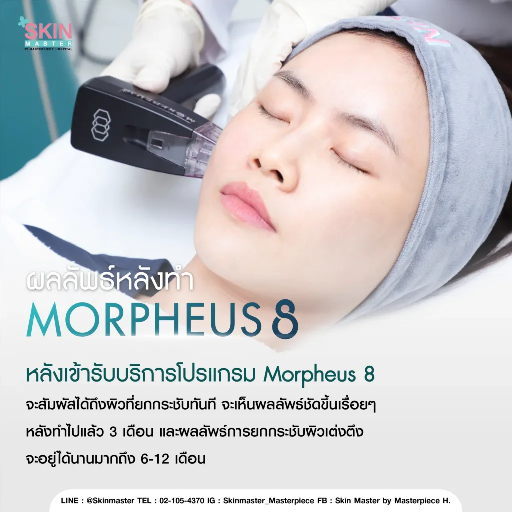 ผลลัพธ์หลังทำ Morpheus8