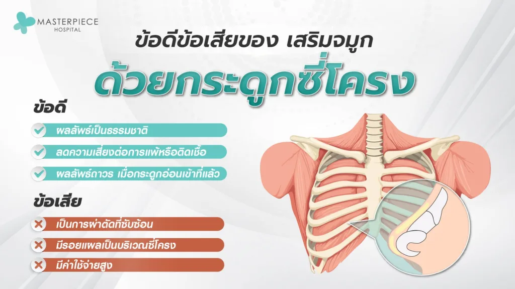 ข้อดีข้อเสียของ เสริมจมูก  ด้วยกระดูกซี่โครง