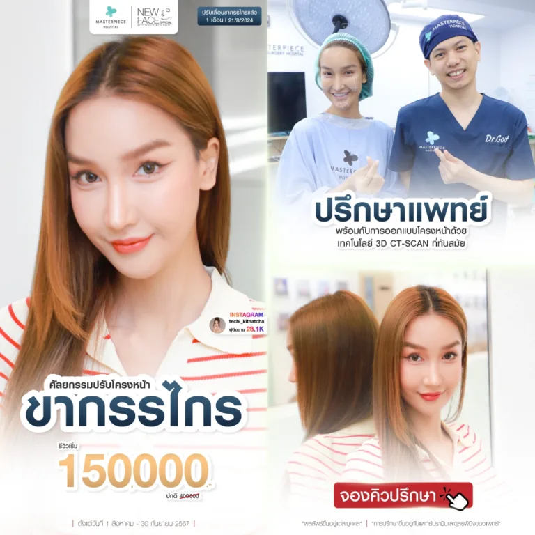 promotion กัยาศัลยกรรม ขากรรไกร 150000