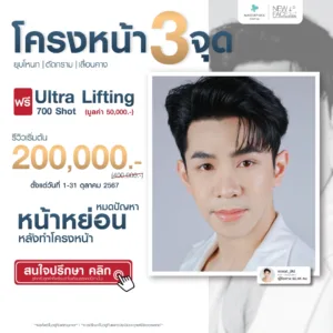 โปรโมชั่น โครงหน้าแก้ไข 3 จุด