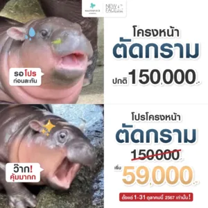 โปรโมชั่นปรับโครงหน้าตัดกราม 59000