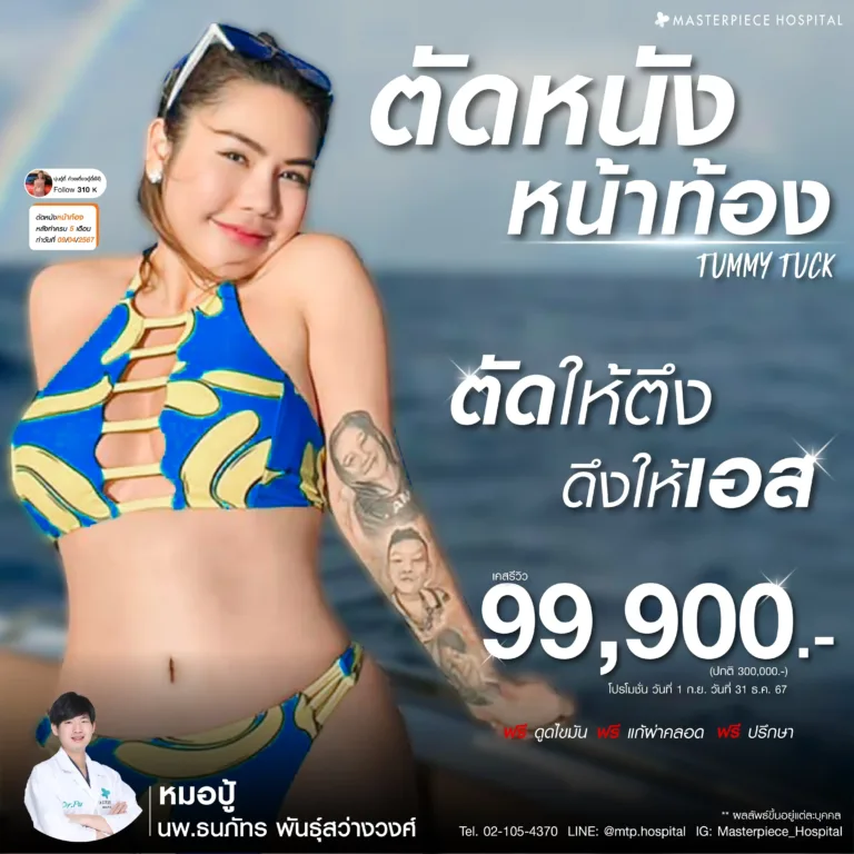 new promotion ตัดหนังหน้าท้อง กันยายน ราคา 99900 หมอปู้_4