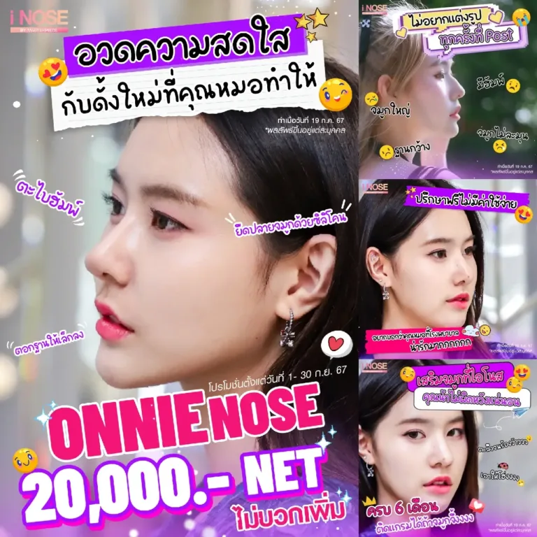 promotion กันยายน เสริมจมูก 20000