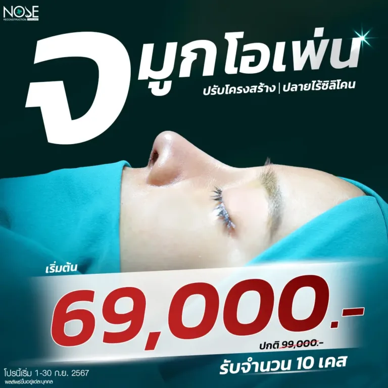 promotion กันยายาน เสริมจมูกโอเพ่น 69000