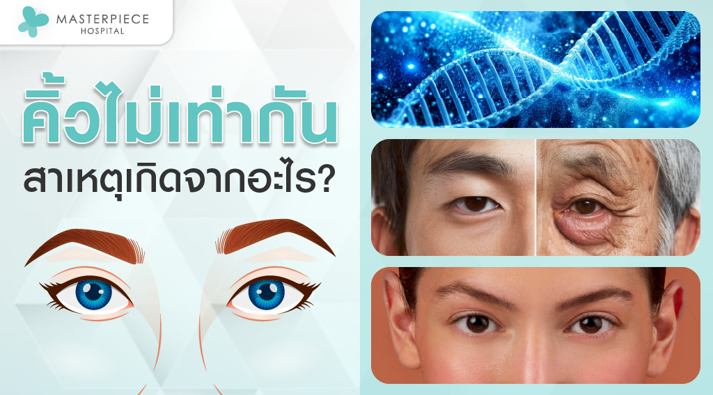 คิ้วไม่เท่ากันสาเหตุมาจากอะไร