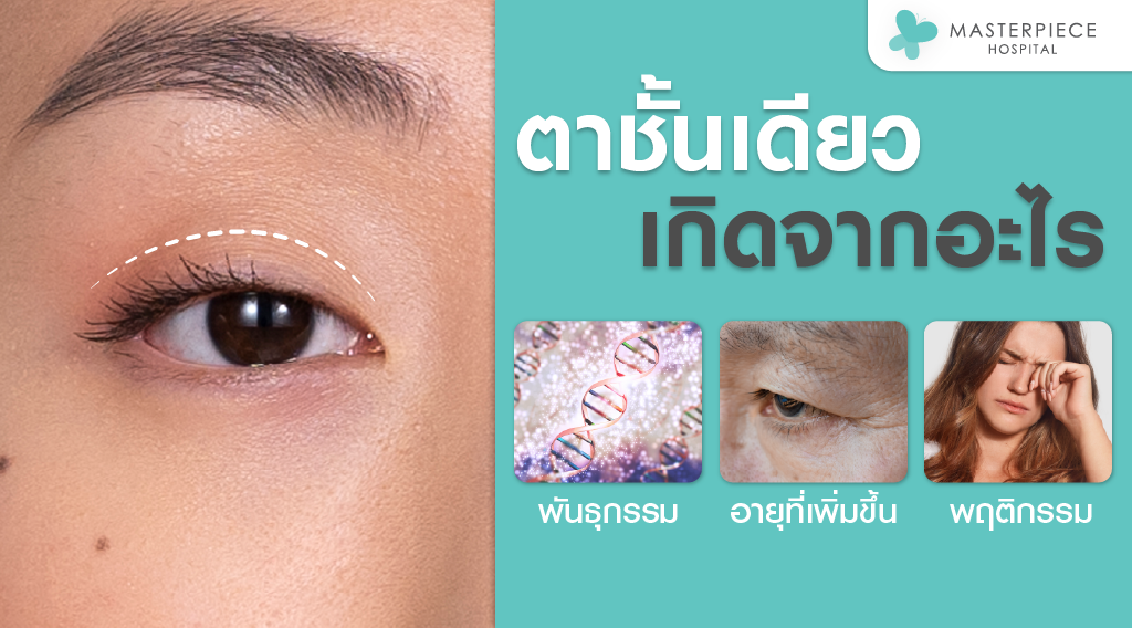 ตาชั้นเดียวเกิดจากอะไร