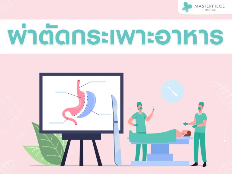 ผ่าตัดกระเพาะอาหาร รักษาโรคอ้วนอย่างได้ผล