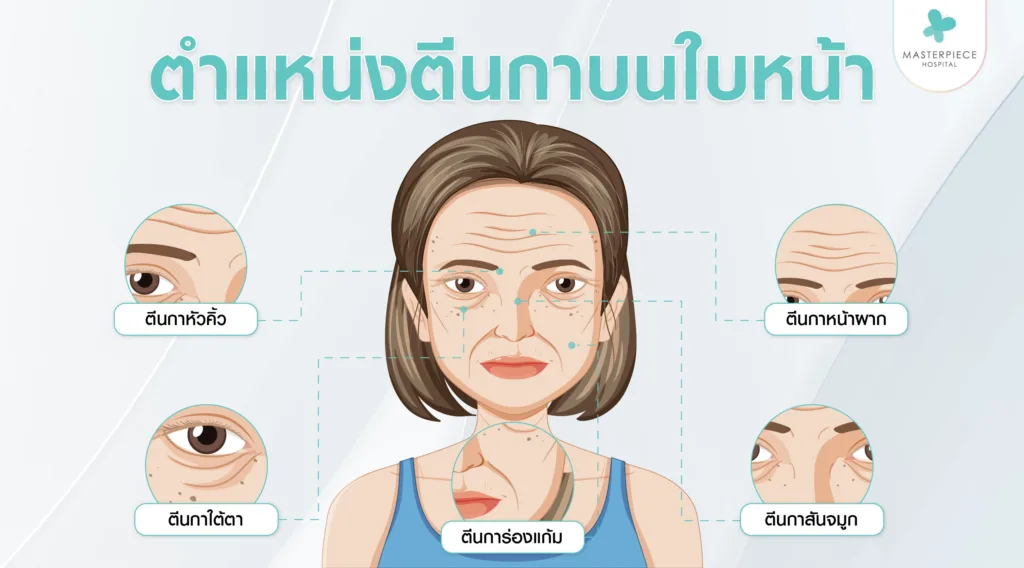 รอยตีนกามีตำแหน่งในบ้างบนใบหน้า