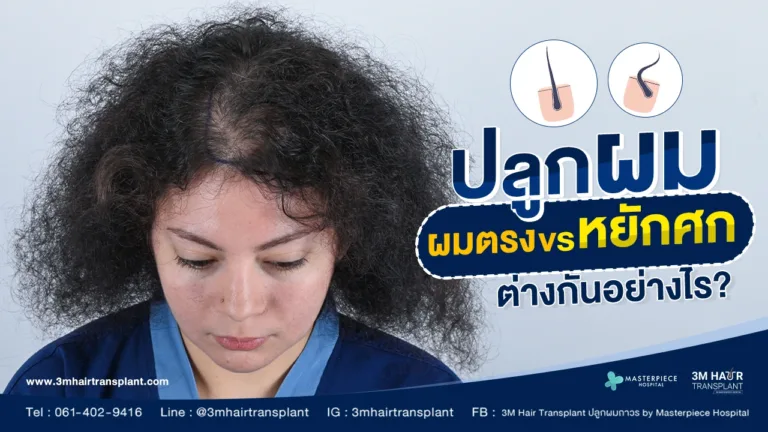 การปลูกผมตรง กับ การปลูกผมหยักศก