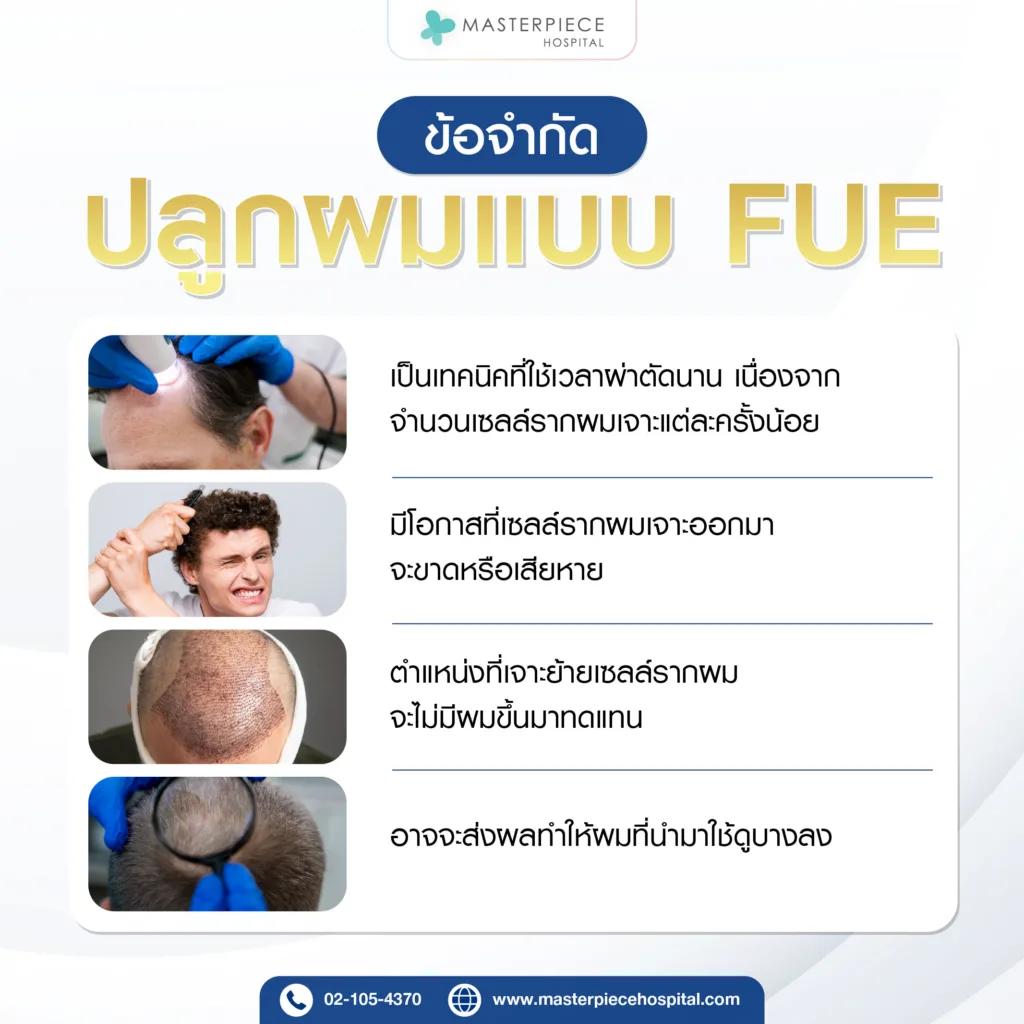 ข้อจำกัดของการปลูกผมแบบ FUE