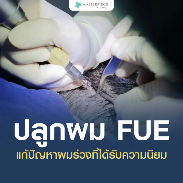 ปลูกผม FUE