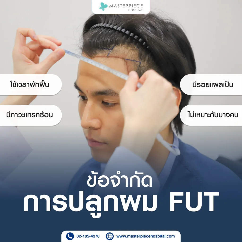 ข้อจำกัดของการปลูกผม FUT